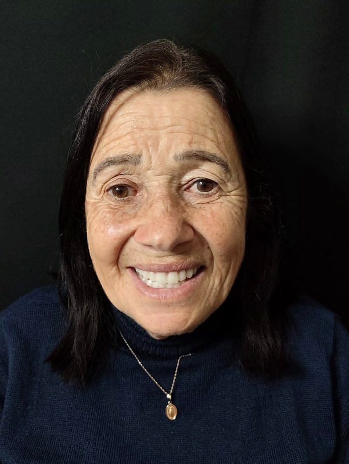 Sorriso depois do tratamento de implante