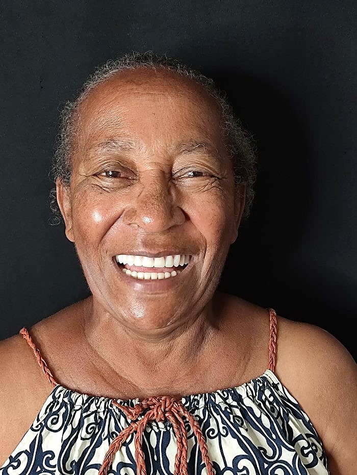Sorriso depois do tratamento de implante